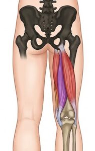 Proximal Hamstring Strain